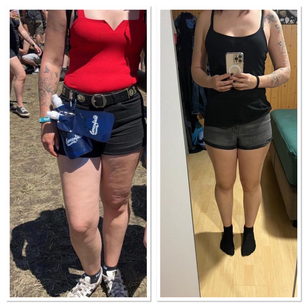 TeoFlow Ergebnis Oberschenkel — 7 Sitzungen