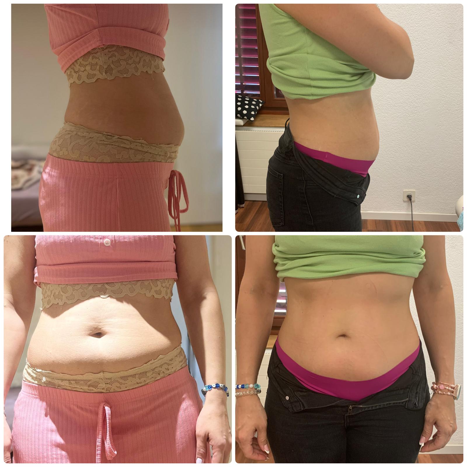 TeoPulse T13 Ergebnis Bauch — 1x 10er-Abo