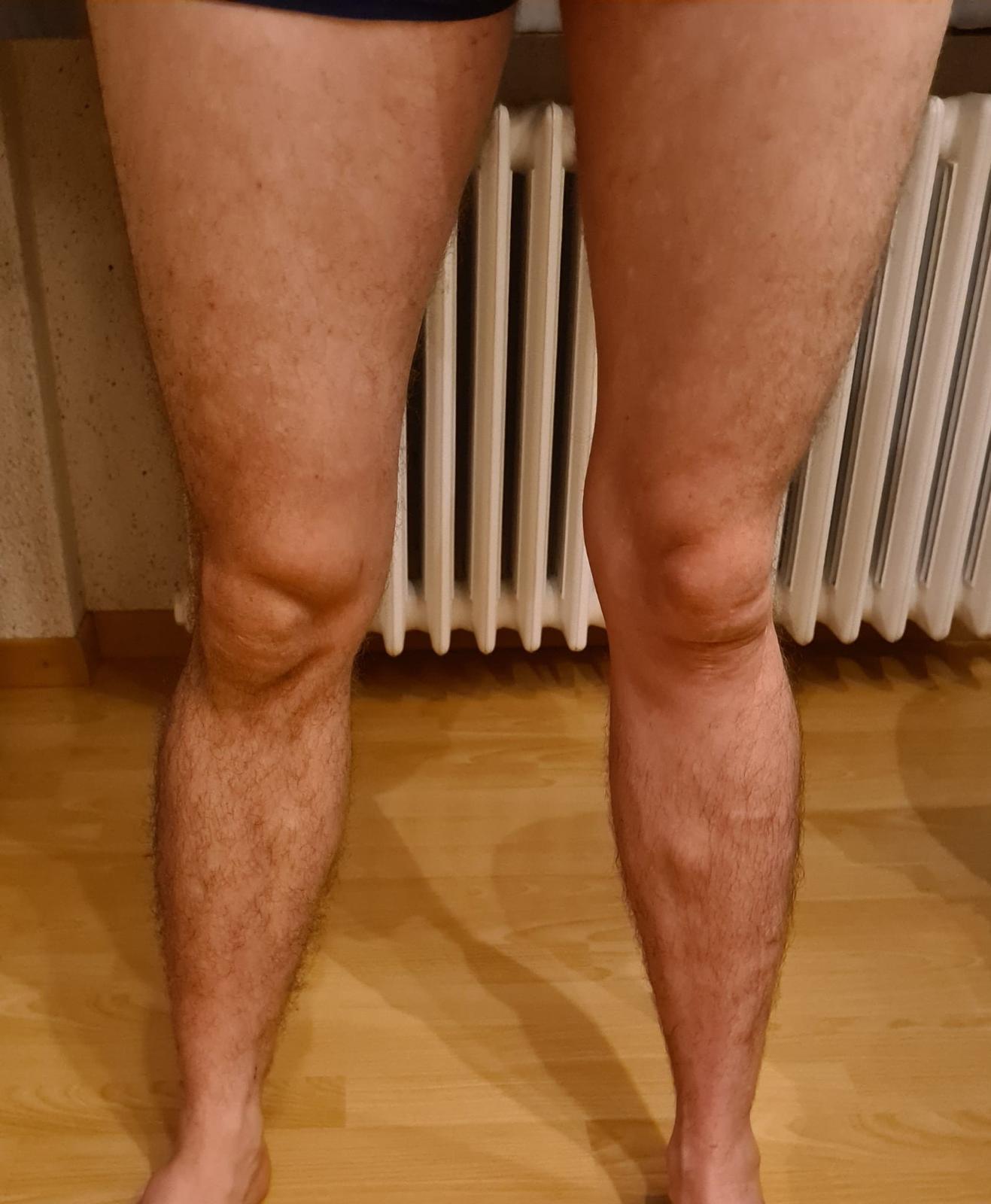 TeoPulse T13 Ergebnis Beine — 5x 10er-Abo